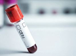 Home Blood Test at Home